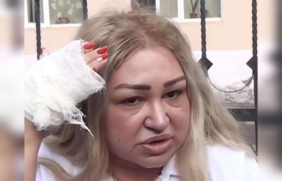 Döyülən müəllim danışdı:&nbsp;“Telefonu başımda qırmaq istədi…” – VİDEO